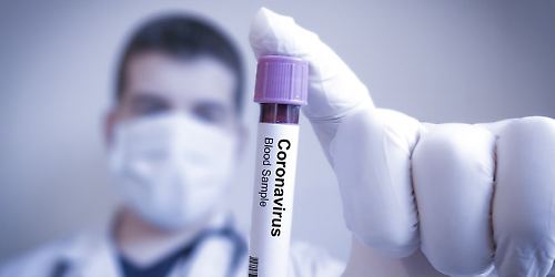 Coronavirus-Bluttest-Shutterstock_image_660.jpg